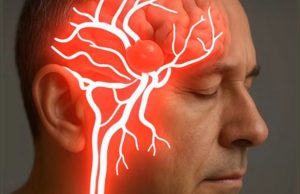 Aneurysm: Doctors misdiagnosed my ruptured brain aneurysm at 37 — the key wa.rning sign they overlooked