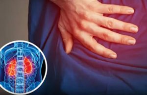 Night Clues: 5 Rare Symptoms Pointing to Kidney D.amage